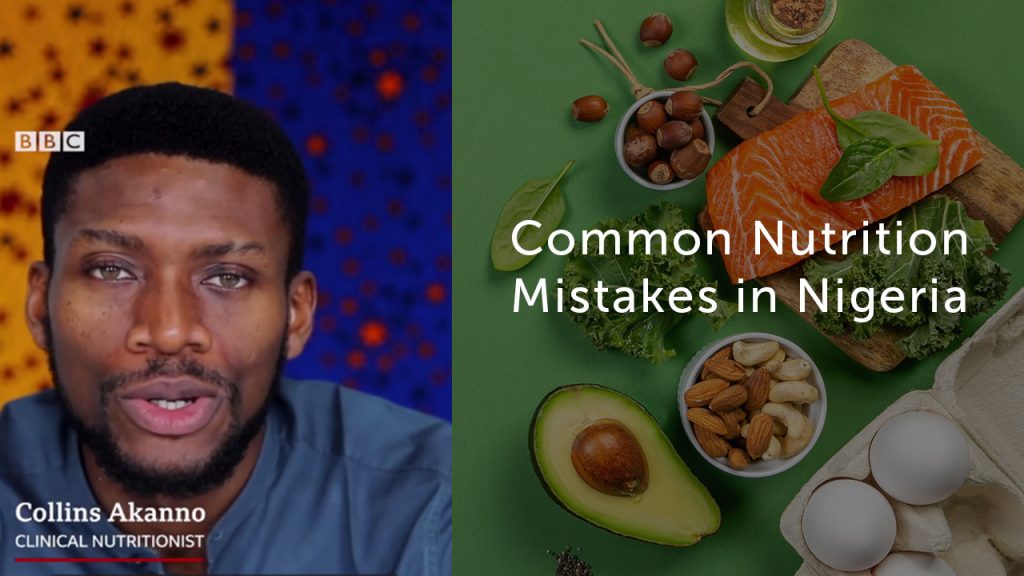 Common-Nutrition-Mistakes